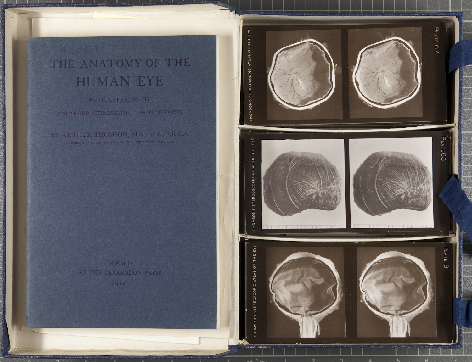The anatomy of the human eye, as illustrated by enlarged stereoscopic photographs, Oxford : At the Clarendon Press, 1912.
