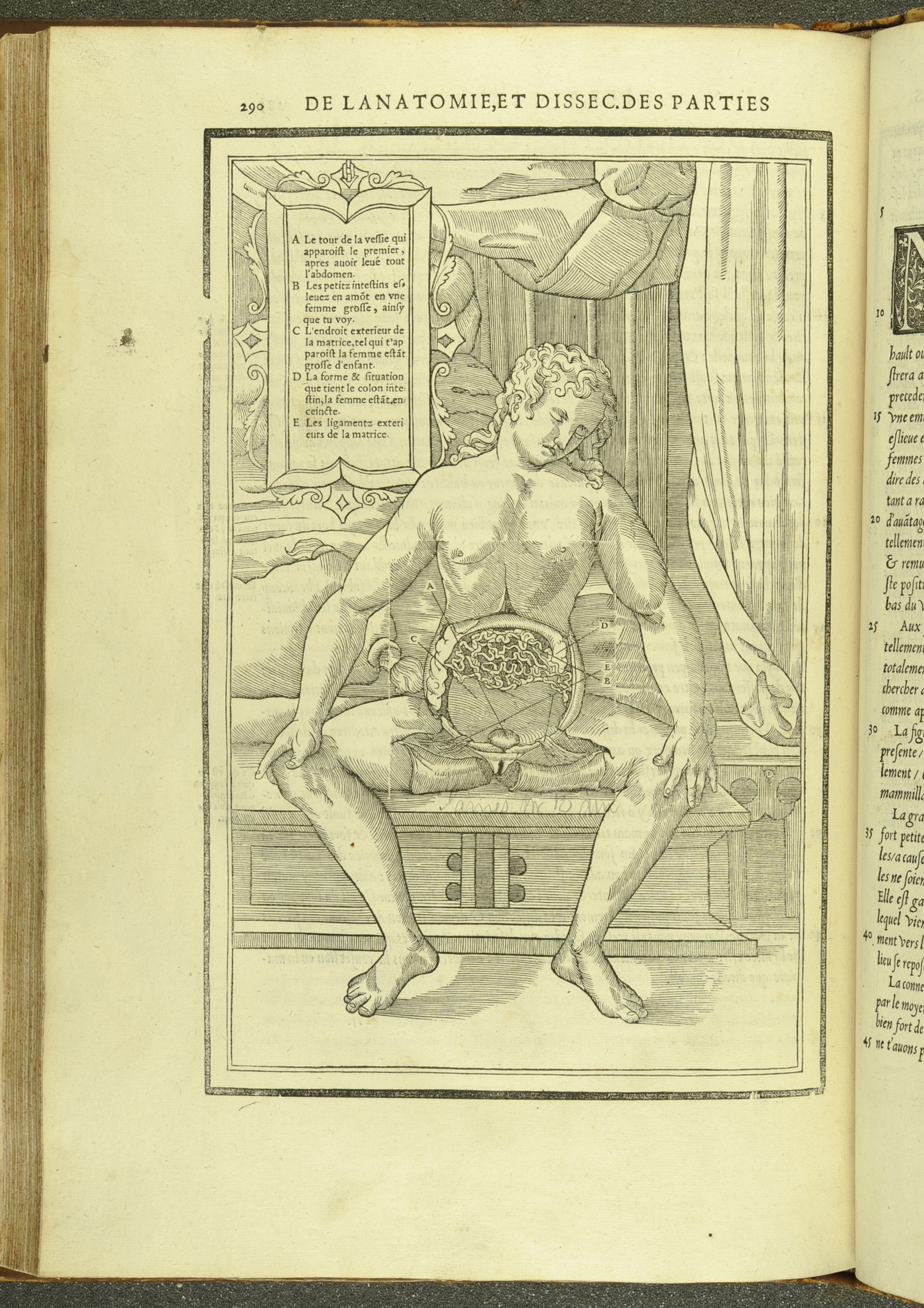 Anatomical depiction of a gravid uterus from Estienne's Anatomy
