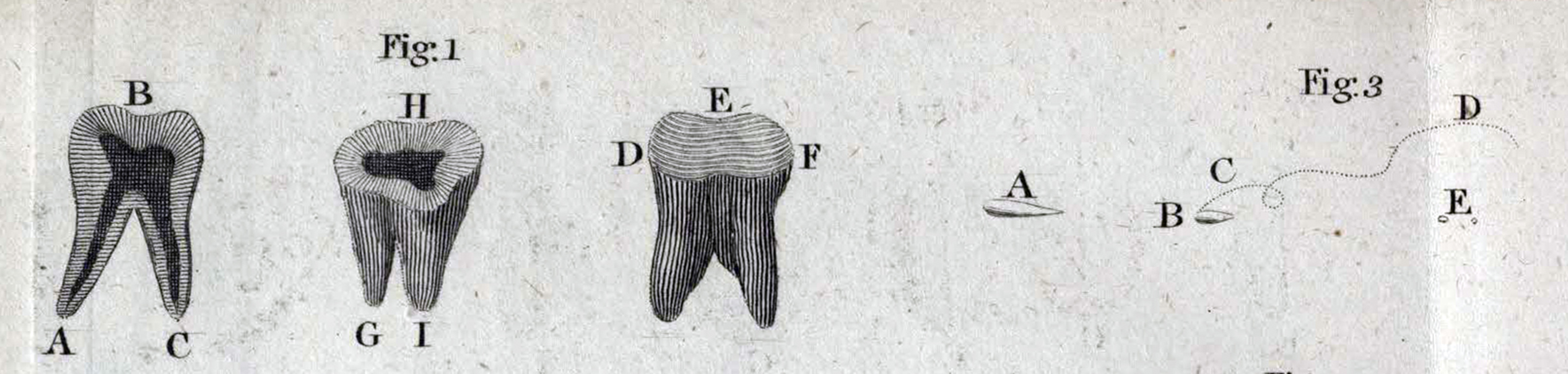Detail from Plate V sQH271.L2H7 showing a whole human molar tooth (Fig. 1 A-I) and the 3 types of ‘animalcule’ observed in the sample scraped from Leeuwenhoek’s teeth (Fig. 3 A, B and E, with the ‘whirling’ motion of type B indicated by the dotted line at C and D).